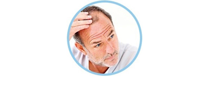 Hair Loss