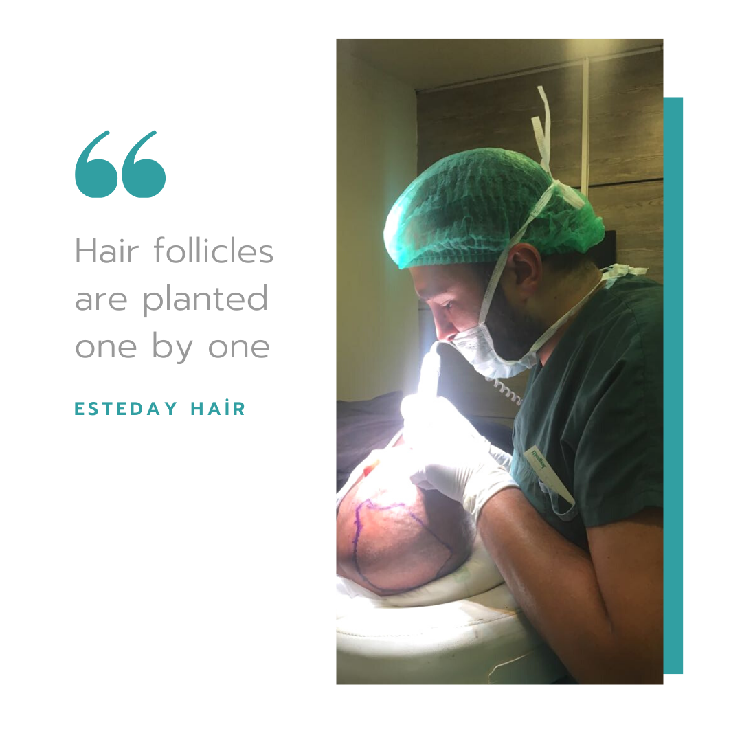 Esteday: Hair Transplant, Aesthetic Operations & Medical Aesthetic