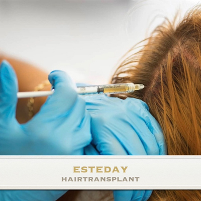 Esteday: Hair Transplant, Aesthetic Operations & Medical Aesthetic