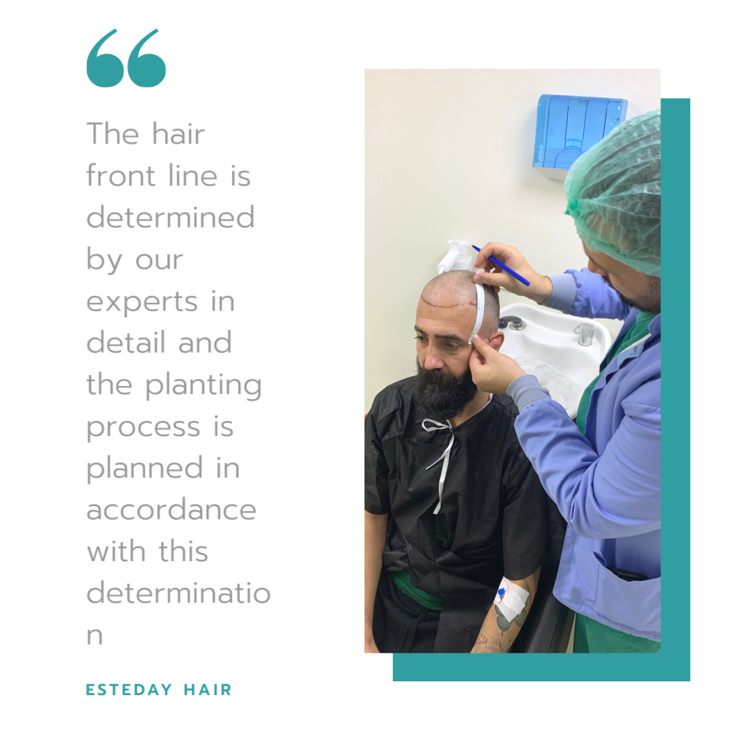 Esteday: Hair Transplant, Aesthetic Operations & Medical Aesthetic